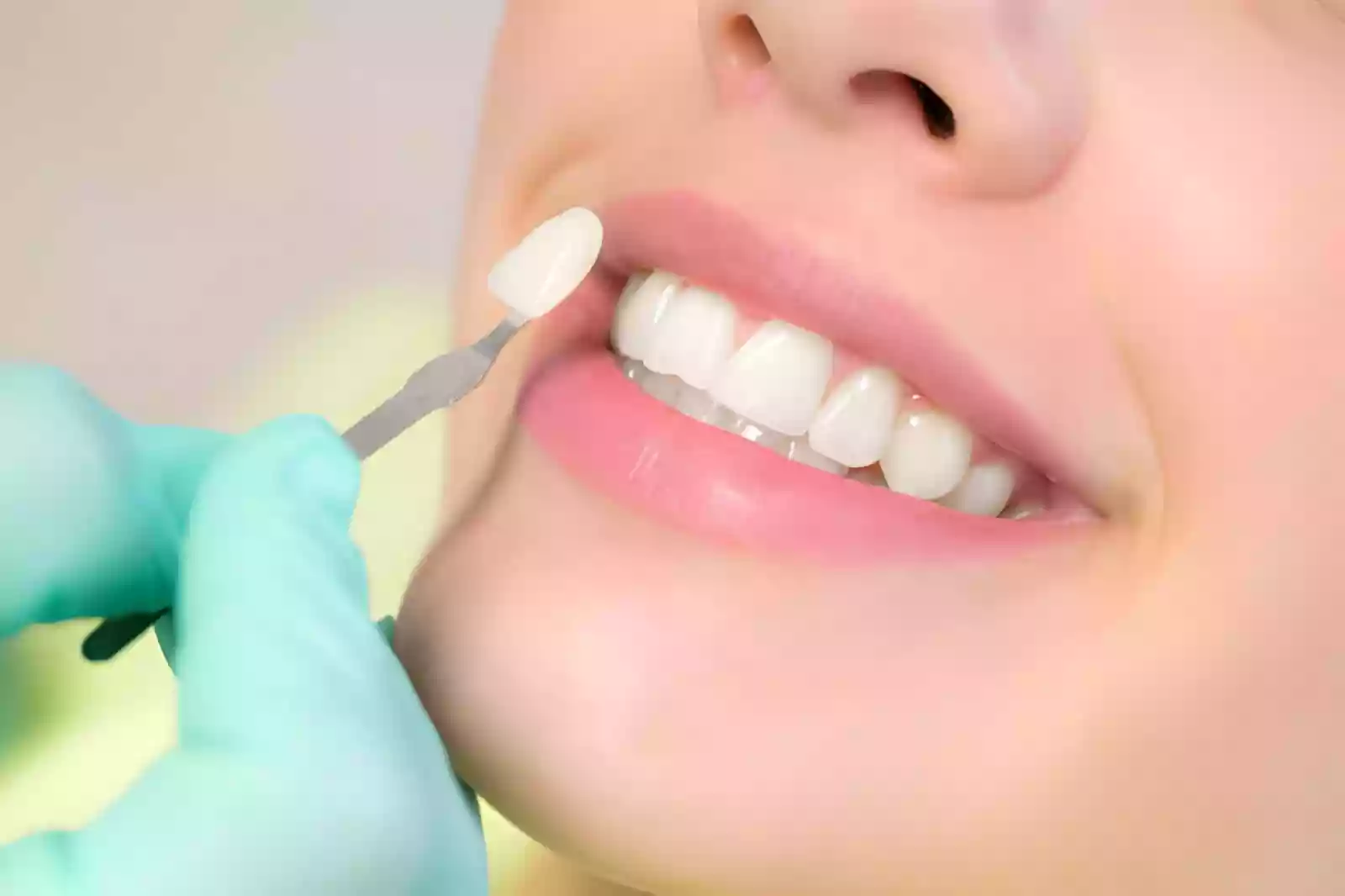 Porcelain Veneers in Bodrum