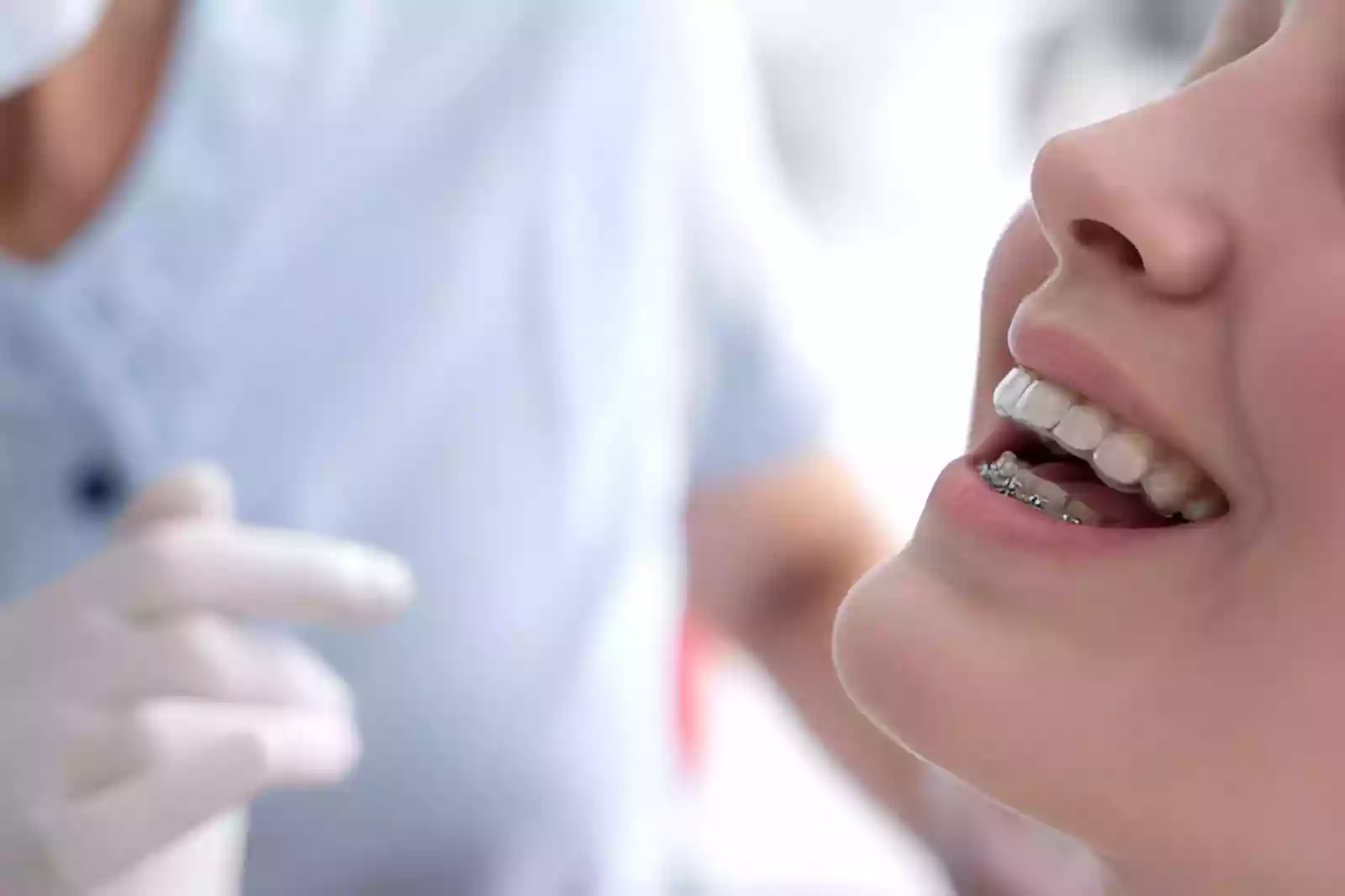 Lingual Orthodontics in Bodrum